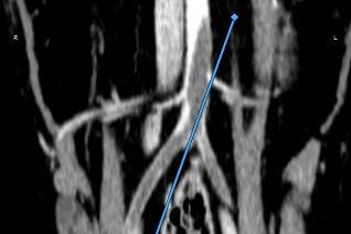 thrombose aortique chez un chien